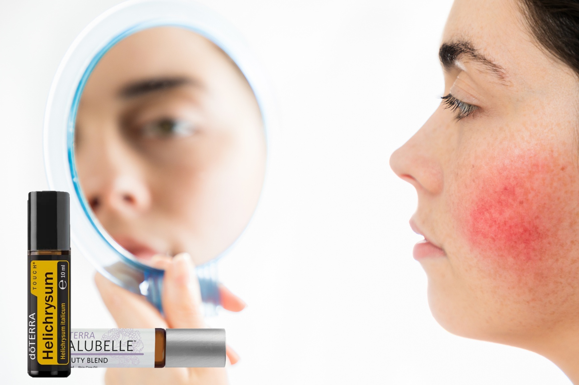 Illóolajok szerepe a rosacea tüneteinek enyhítésében